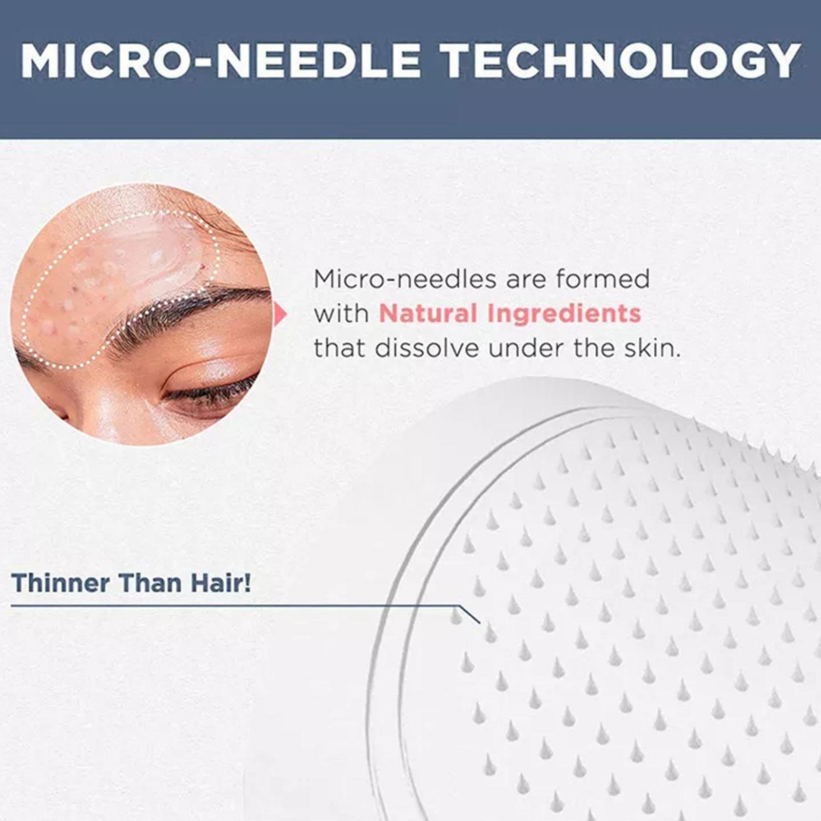 0.2mm Micro-needle Eye Patch M - огляд і ціна Sheet Mask Collagen